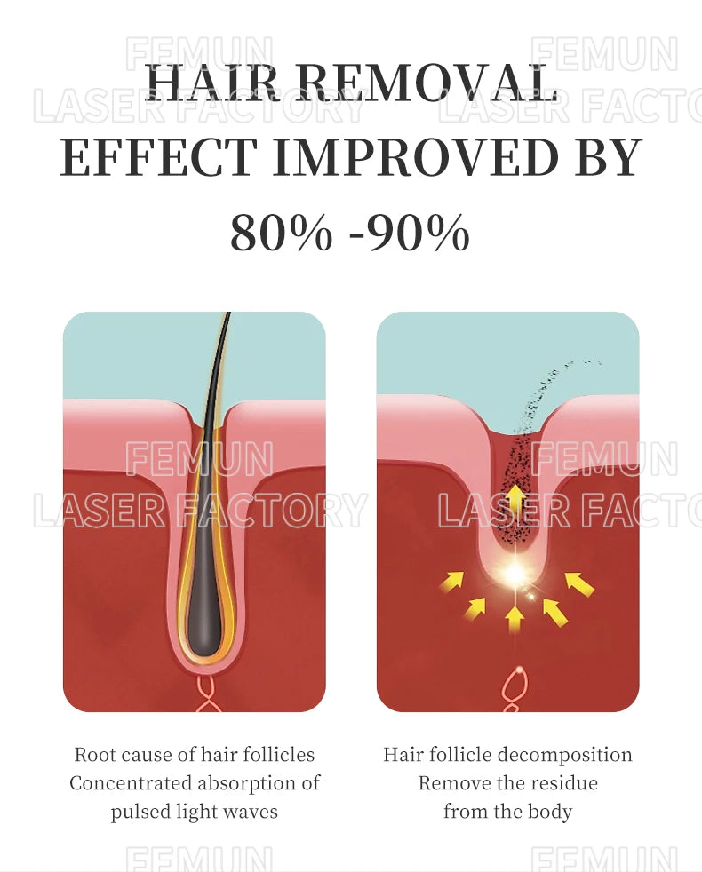 4-in-1 4000W Laser Hair Removal Machine – Painless 2025