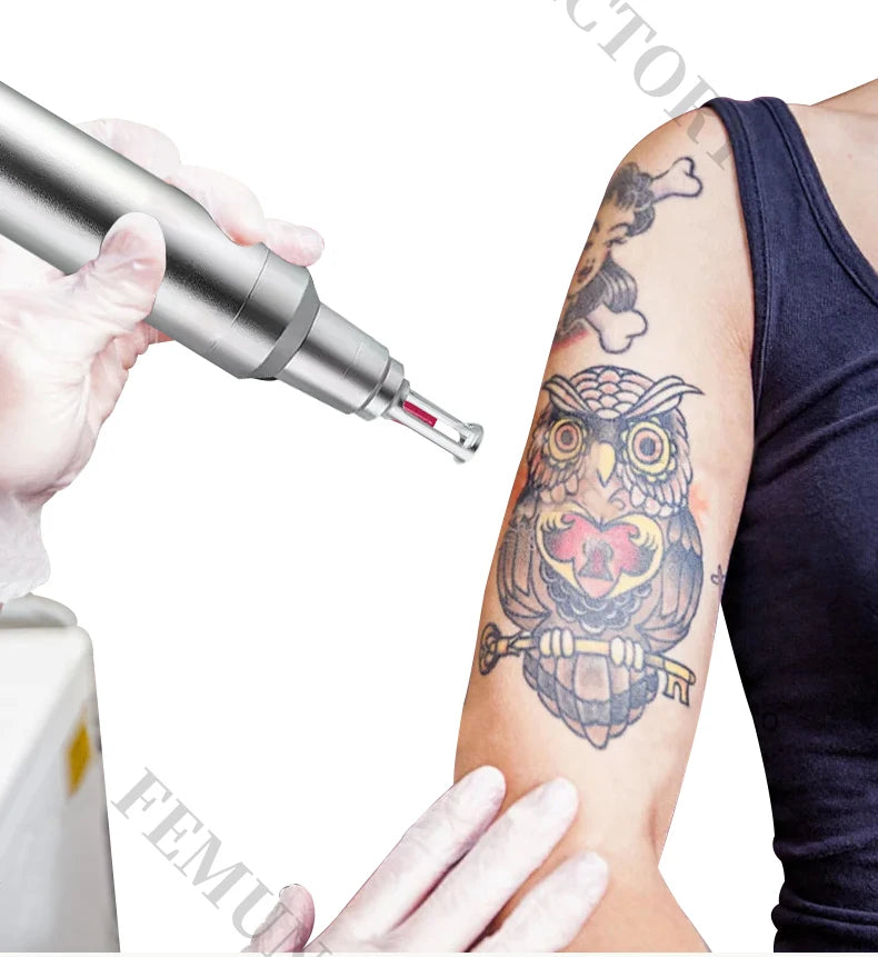 4-in-1 4000W Laser Hair Removal Machine – Painless 2025