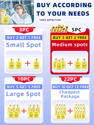 Eelhoe Dark Spot Remover for Freckles & Melasma Care