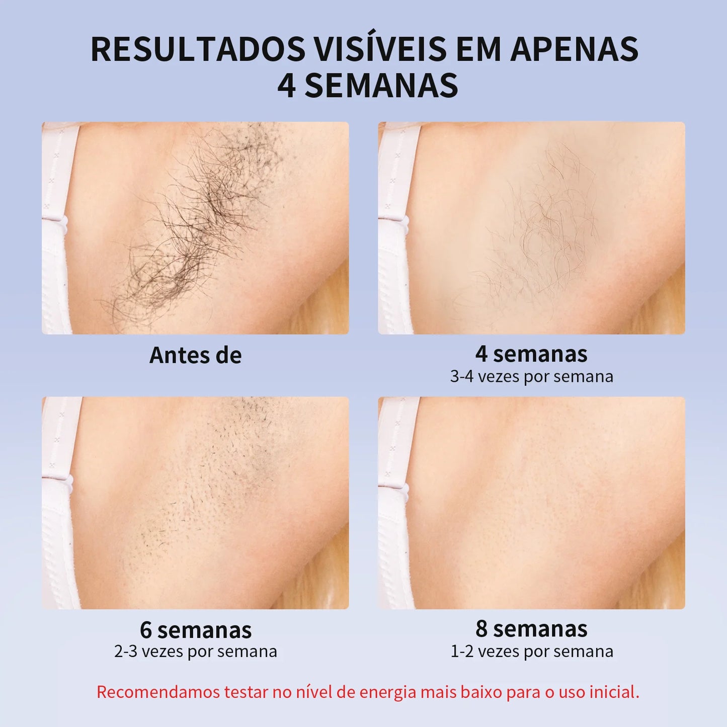 Laser Hair Removal Device – IPL ICE Cooling Epilator