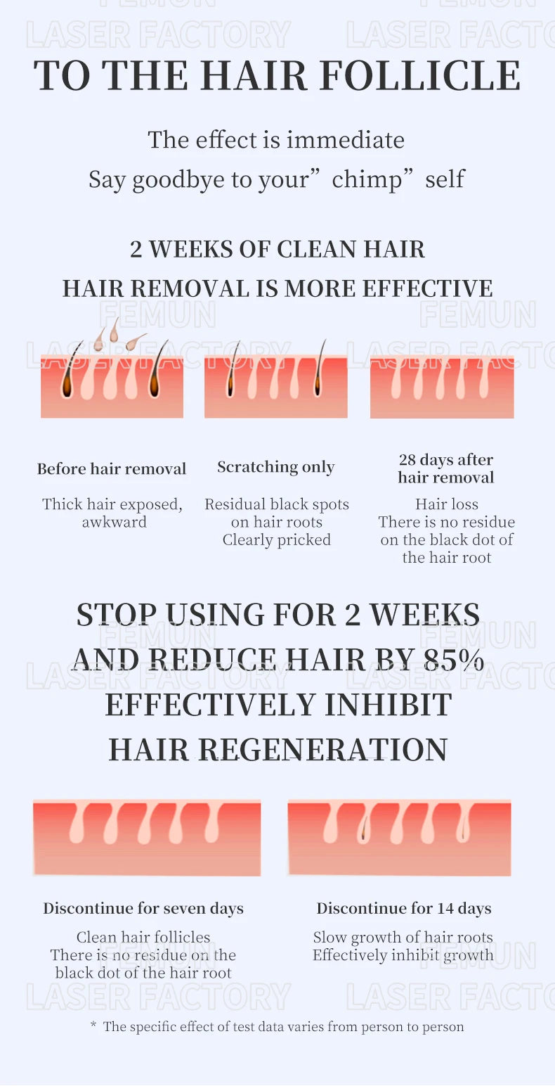 4-in-1 4000W Laser Hair Removal Machine – Painless 2025