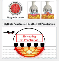 Venus Legacy 4DTM Pro Fat Burner Slimming, Firming Anti-Cellulite Fat Reduction Lift Anti-Aging Device Fat Lift Anti-Aging