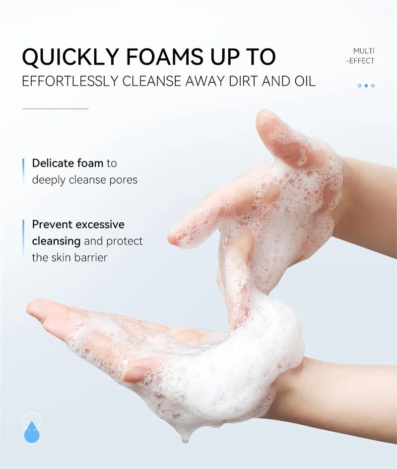Deep Cleansing Facial Foam – Acne & Dark Spot Remover