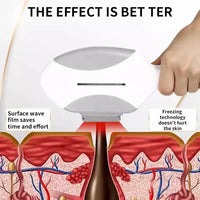 4-in-1 4000W Laser Hair Removal Machine – Painless 2025