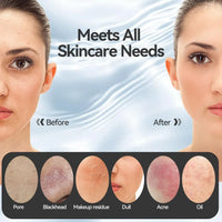 Heated Silicone Facial Cleansing Brush – 5 Speed Rechargeable