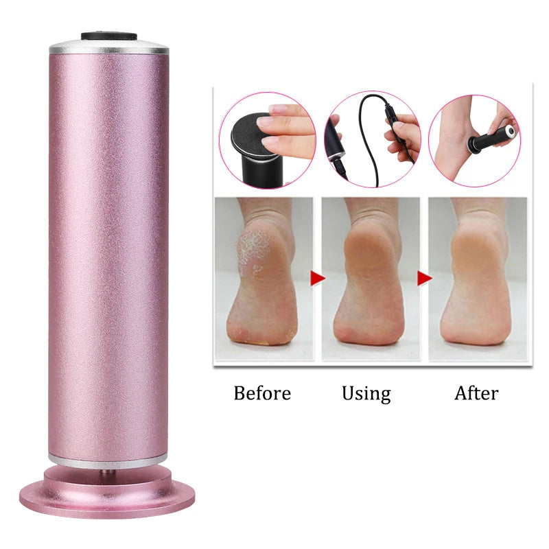 Electric Pedicure Foot File – Callus Remover w/ Sandpaper