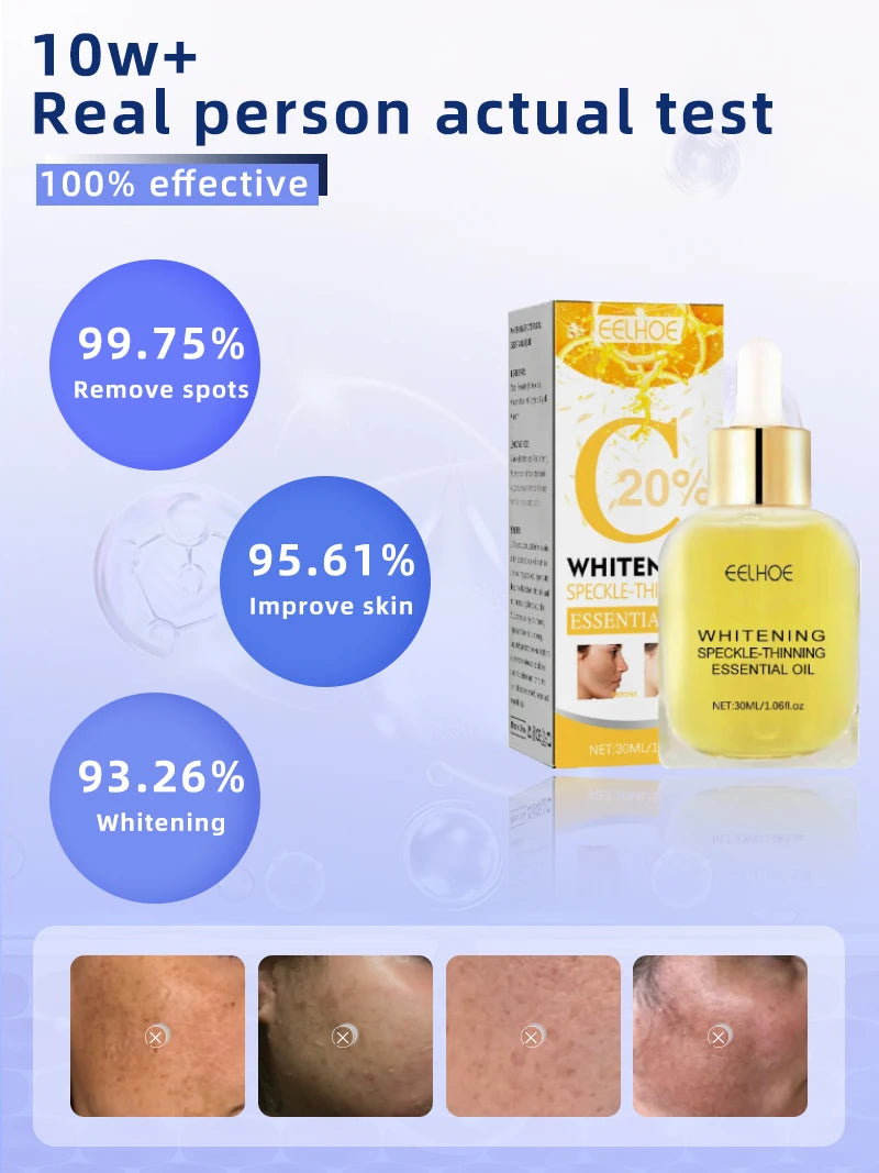 Eelhoe Dark Spot Remover for Freckles & Melasma Care