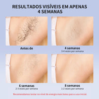 Laser Hair Removal Device – IPL ICE Cooling Epilator