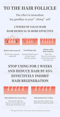 4-in-1 4000W Laser Hair Removal Machine – Painless 2025