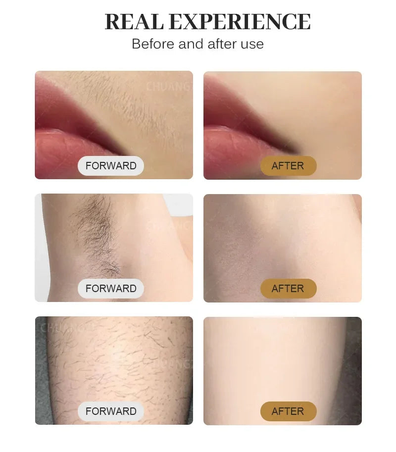 Profession 808nm Diode Laser Hair Removal Machine 3000W PRO Ice Platinum Painless Permanent Epilator For Salon