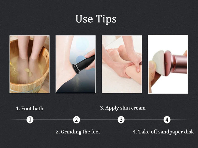 Electric Pedicure Foot File – Callus Remover w/ Sandpaper